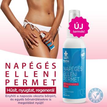 WTN Napégés elleni permet 100ml 1.Kép